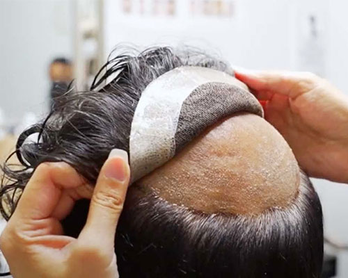 Hair Patch